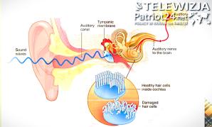   [VIDEO] Słyszę ludzi ale ich nie rozumiem. Dlaczego tak się dzieje? Nowy cykl: „Wykłady Marty Szkiełka”. To wybitna protetyk słuchu, technik audiologiczny, andragog z Żar w województwie lubuskim